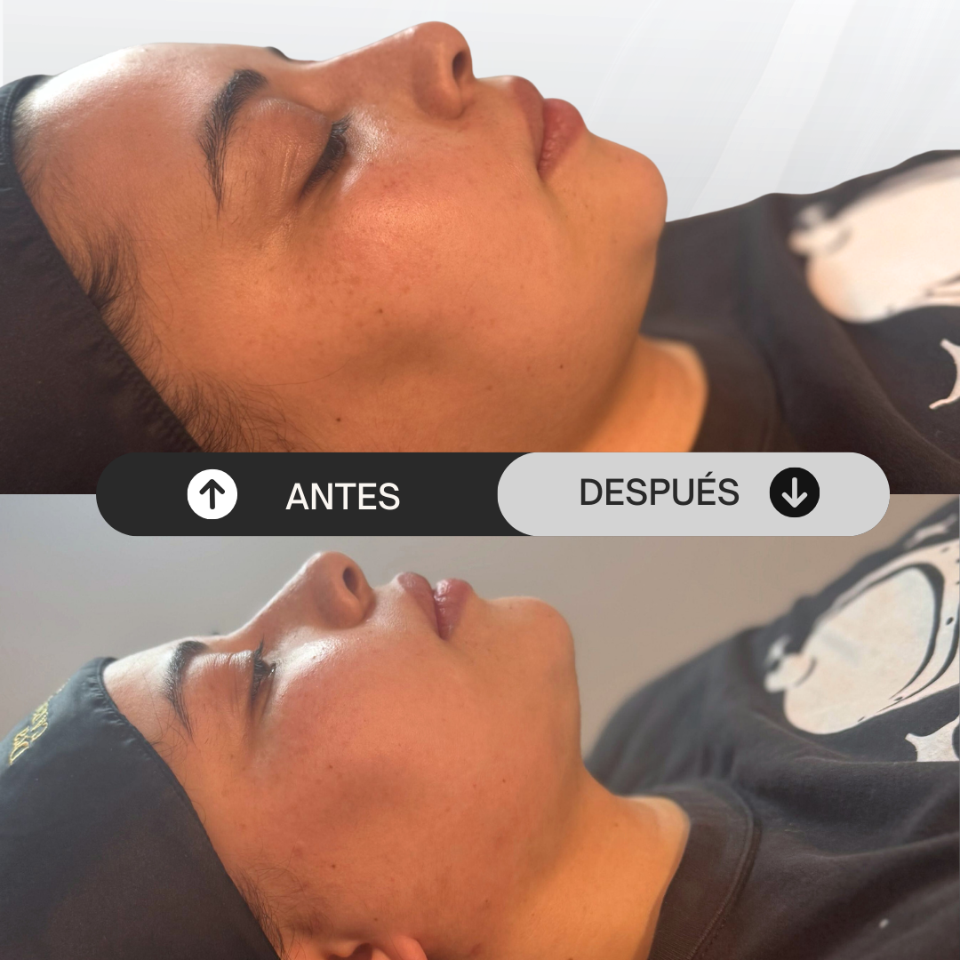 A-D_4-Rodriguez
